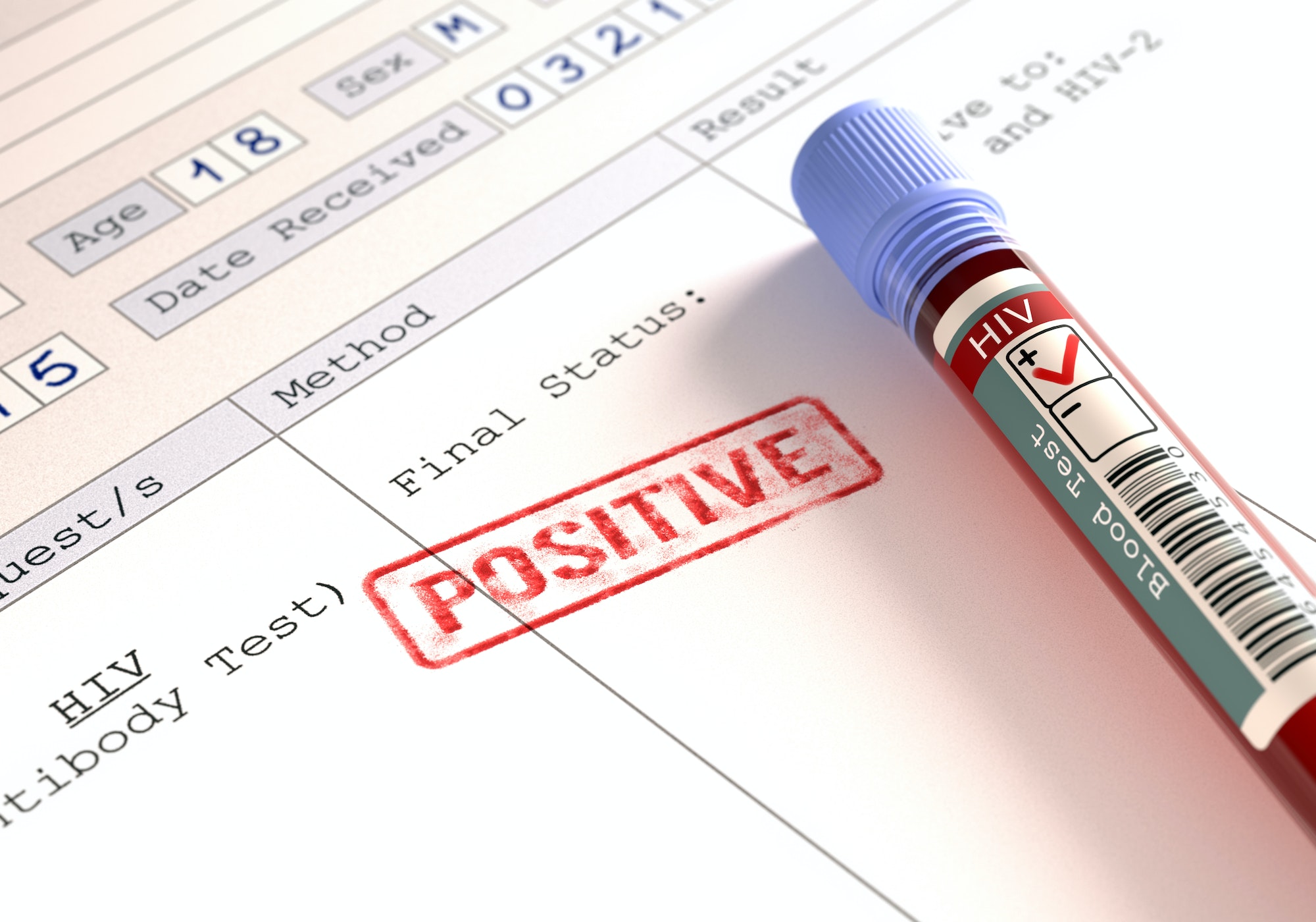 HIV Positive